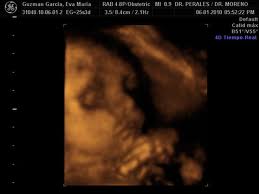 hamilelik 19. hafta 3 ve 4 boyutlu ultrason görüntüsü