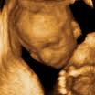 hamilelik 19. hafta 3 ve 4 boyutlu ultrason görüntüsü
